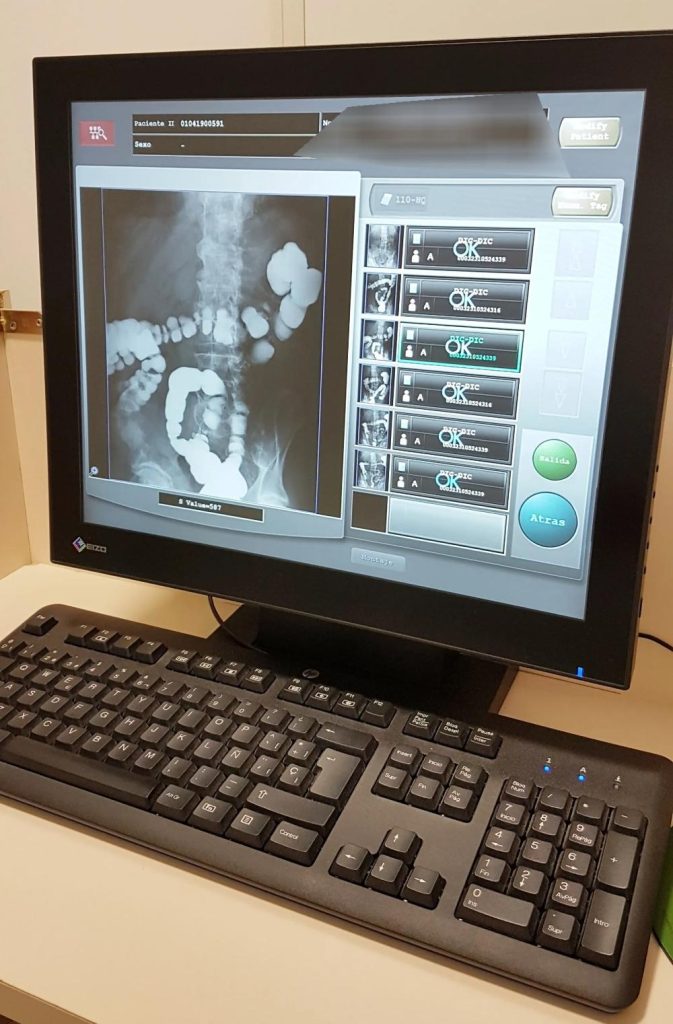ordenador con radiografías